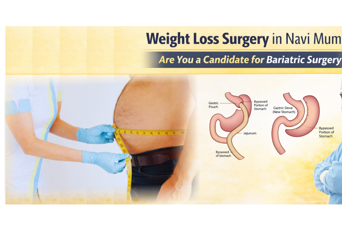 Weight loss surgery