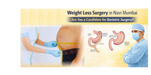 Weight loss surgery