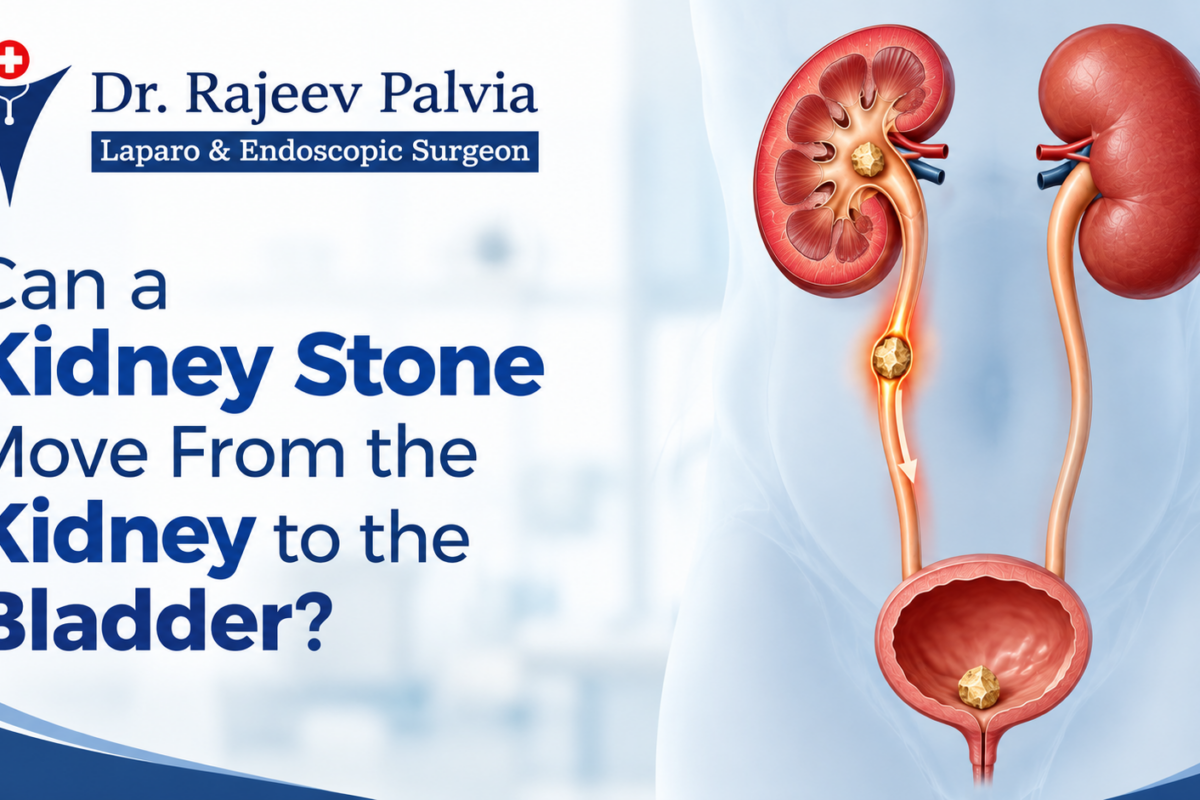 Kidney-Stone-Specialist-in-Kharghar