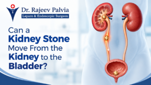 Kidney-Stone-Specialist-in-Kharghar